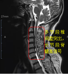 162722w2nn55ax88sa2v2a.png