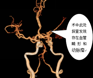 144243cwjn4op2i2qhpon8.png