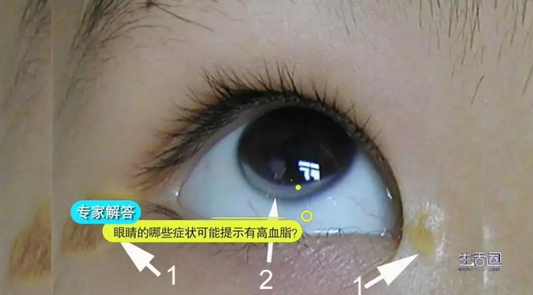 094059o8ejcrp8pegp1j58.png