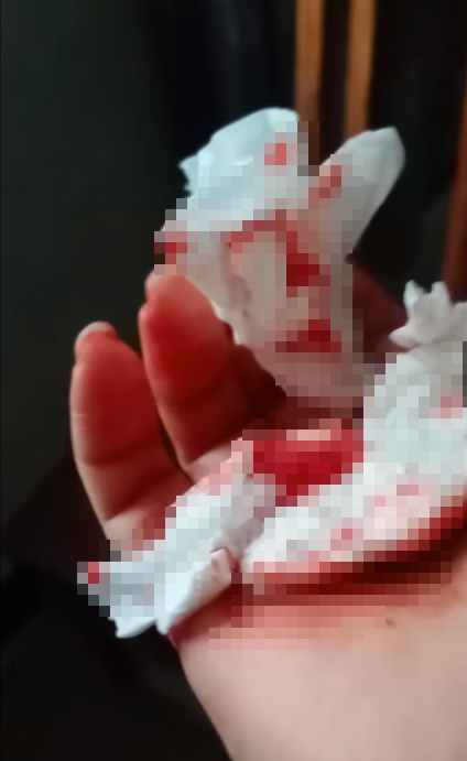 151613una5c0gnzs5nk5nc.png